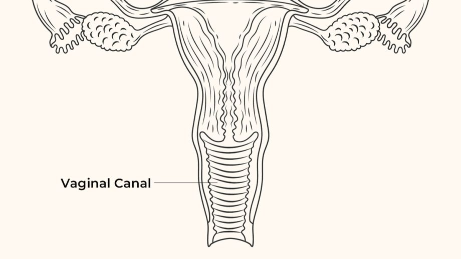Detailed anatomical illustration showing the vaginal canal, cervix, uterus, and surrounding structures.